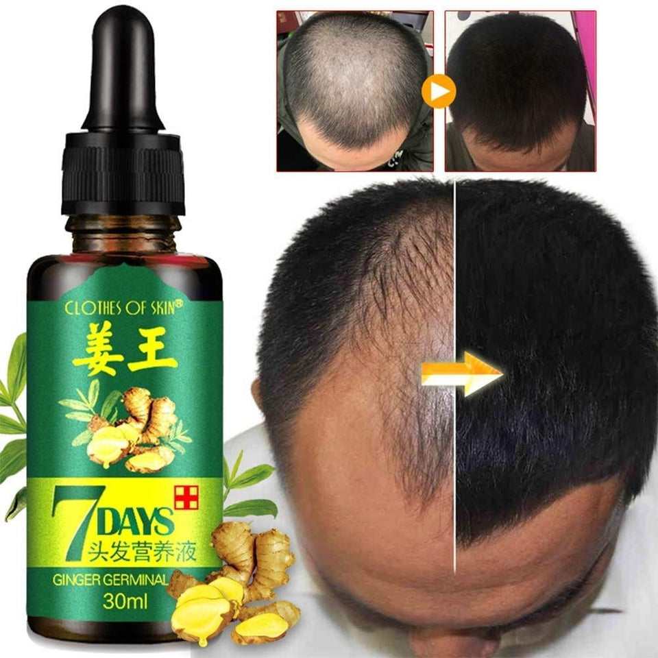 2X1 KING OF GINGER - SERUM CAPILAR